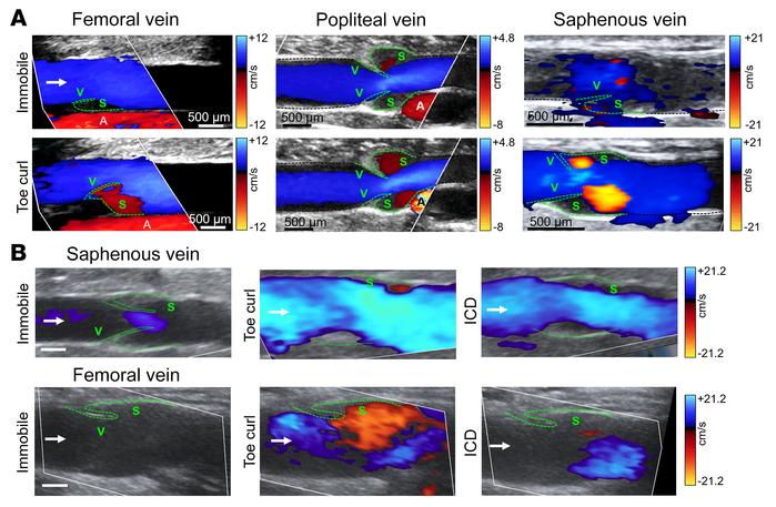 Oscillatory flow in the venous valve sinus is stimulated by muscular act...