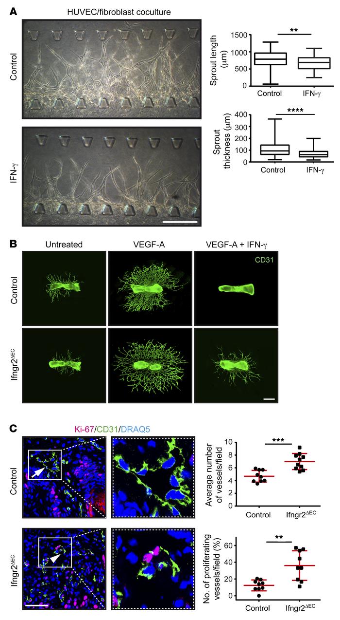 IFN-γ exerts angiostatic effects in vitro, ex vivo, and in vivo.
(A) In ...