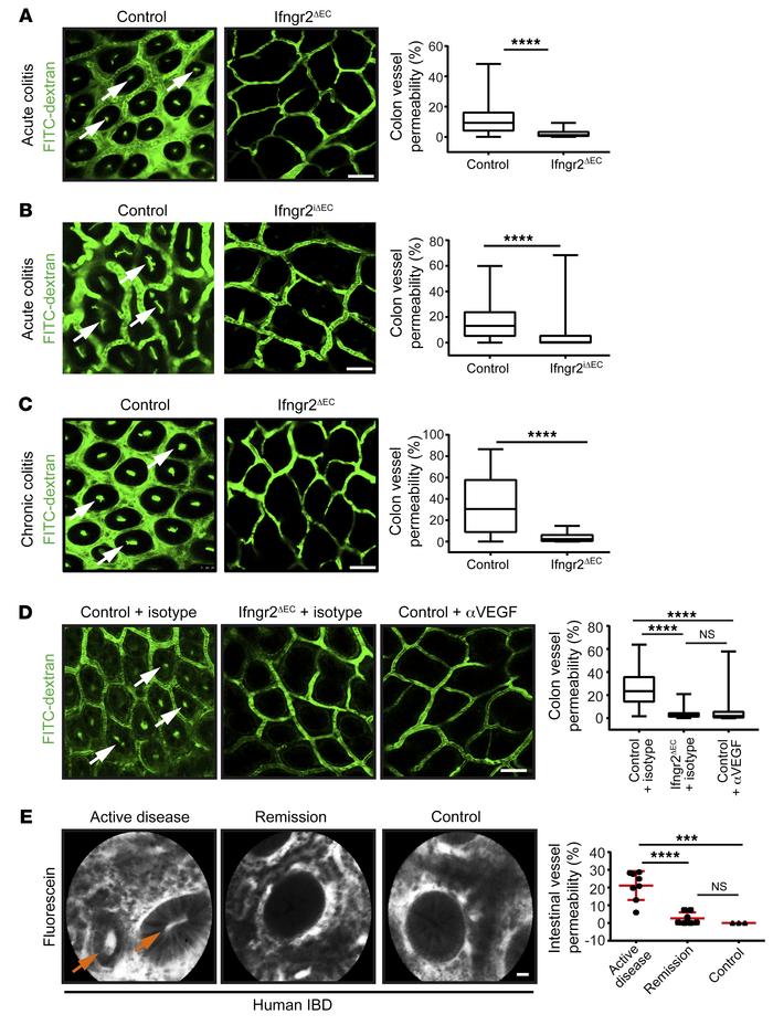 The intestinal vasculature is characterized by IFN-γ–mediated barrier dy...