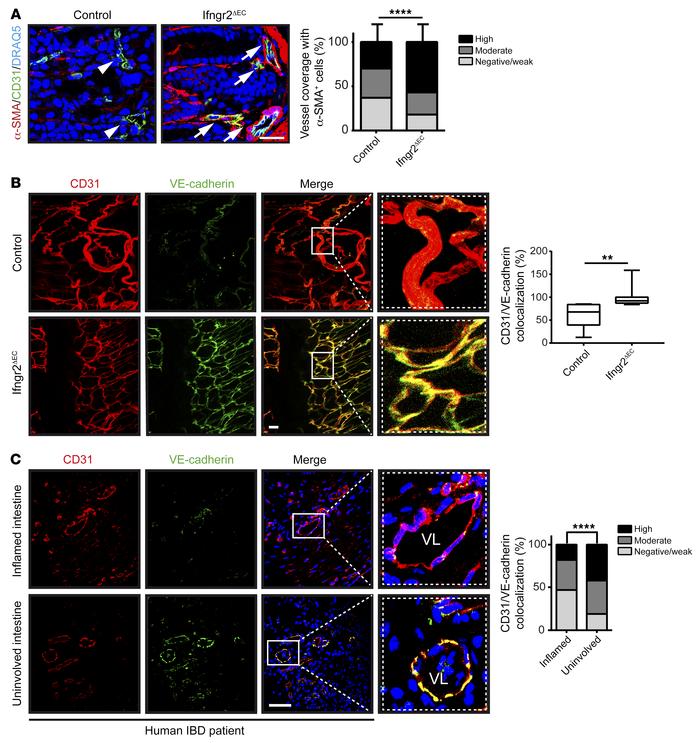 IFN-γ compromises mural cell coverage and VE-cadherin–mediated cell-cell...