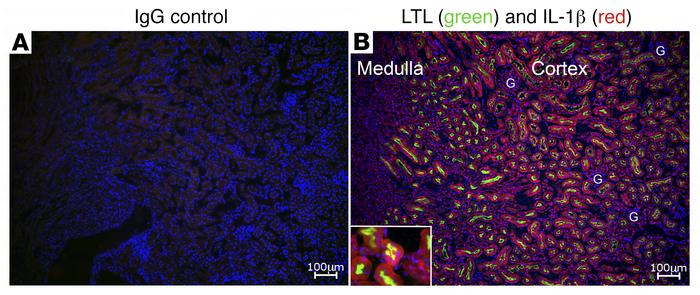 The proximal tubules of Stat1+/+ mice produce IL-1β following treatment ...