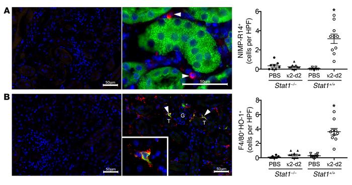 FLCs induce a peritubular inflammatory infiltrate that includes neutroph...