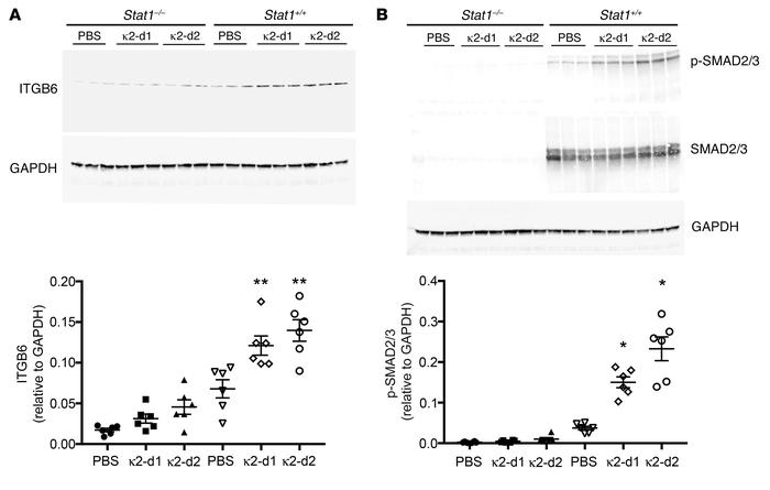 Treatment of Stat1+/+ mice with κ2 FLC promotes an increase in ITGB6 and...