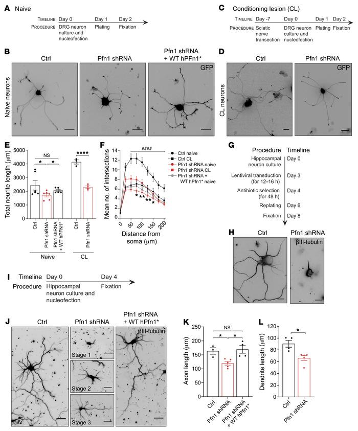 Pfn1 downregulation impairs axonal growth in vitro in different neuronal...