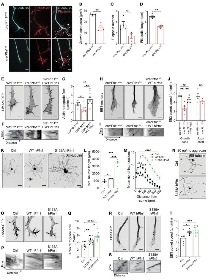 Pfn1 regulates actin and MT dynamics in growth cones.
(A) βIII-tubulin (...