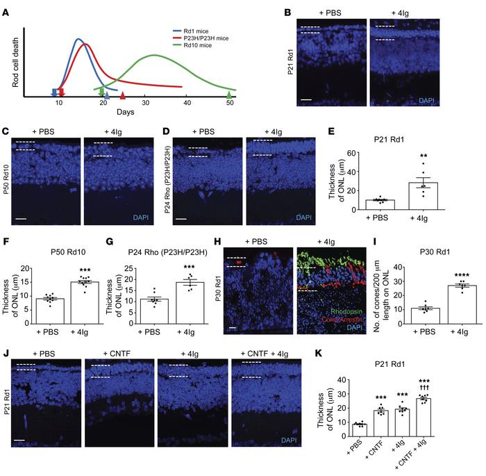 Blocking neogenin promotes photoreceptor survival.
(A) Timing of rod dea...