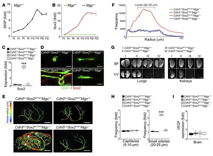 Suppression of Sox2 reduces cerebral AVMs.
(A) Time-course expression of...