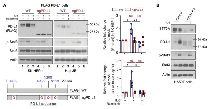 IL-6/JAK1 pathway upregulates PD-L1 expression via N-glycosyltransferase...