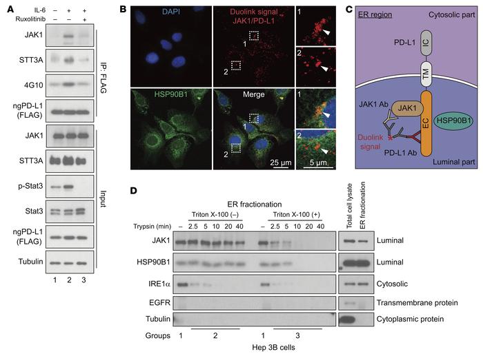 IL-6 pathway enhances JAK1/ngPD-L1 and STT3A/ngPD-L1 complex formation.
...