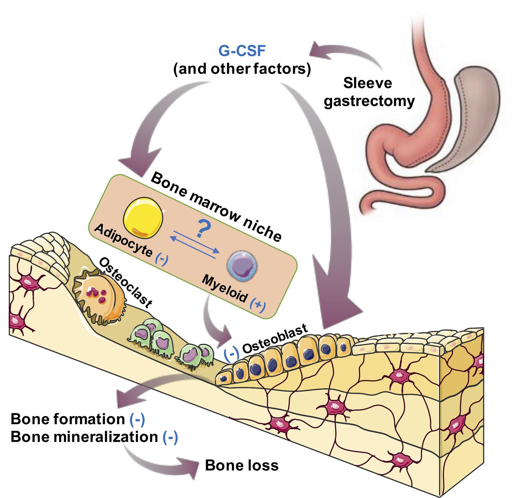 JCI - G-CSF partially mediates effects of sleeve gastrectomy on the ...