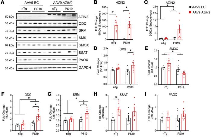 AZIN2 overexpression induces tau-dependent effects on polyamine enzymes....