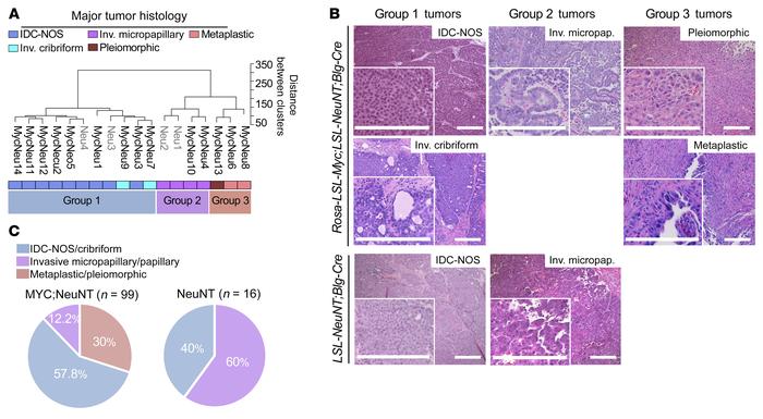 Deregulated MYC expands intertumoral heterogeneity.
(A) Unsupervised hie...