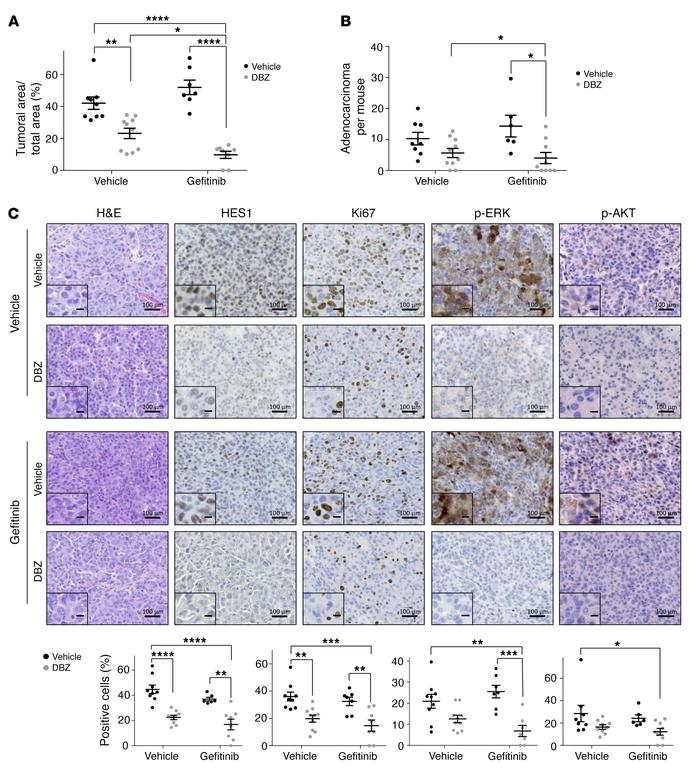 Notch inhibition sensitizes mouse EGFRT790M/L858R-driven tumors to gefit...
