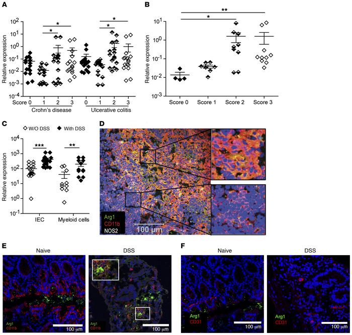 Expression of Arg1 in human IBD and mouse DSS-induced colitis.
(A–C) Usi...