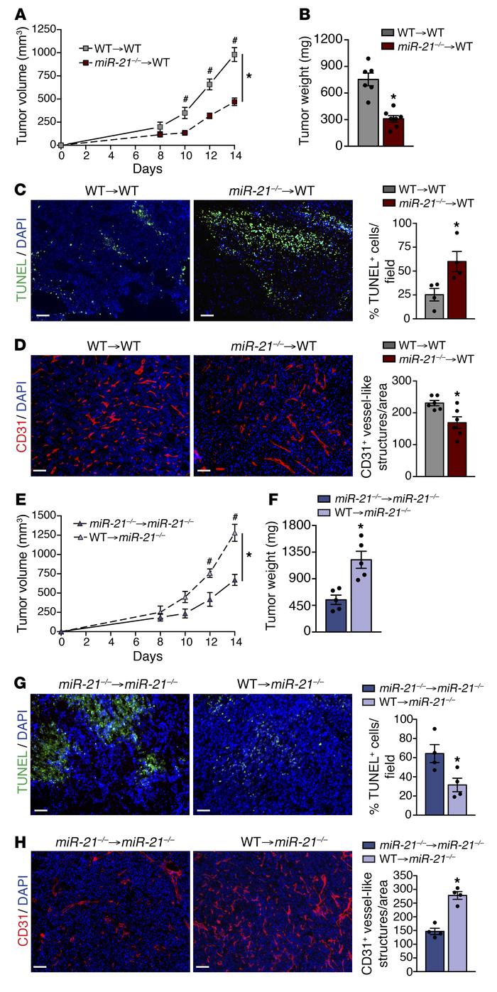 Hematopoietic miR-21 regulates and promotes tumor progression.
(A–D) Tum...