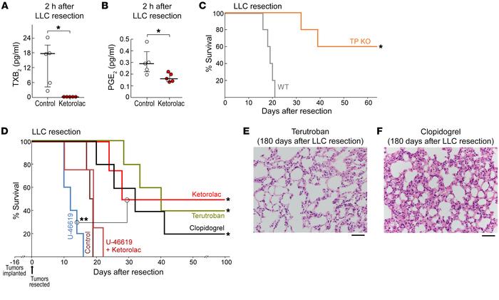 COX-1/TXA2 inhibition mediates the antitumor activity of ketorolac.
LC-M...