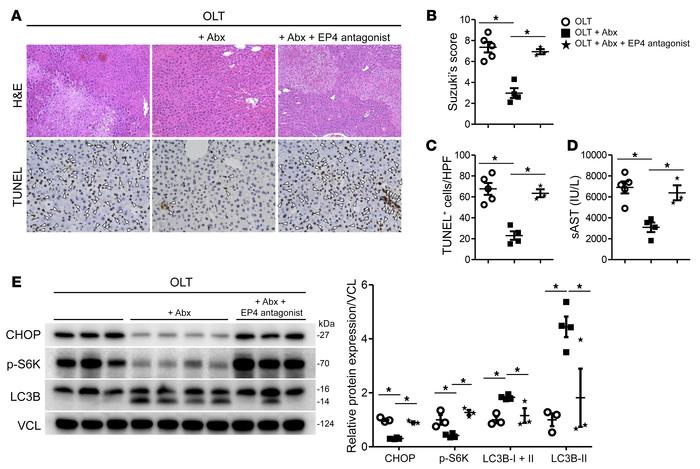 EP4 antagonism restores CHOP, decreases LC3B, and recreates IR-hepatocel...