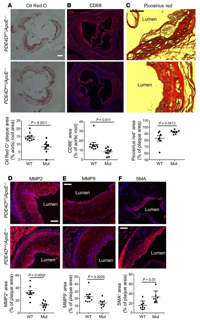 Atherosclerosis and recovery from hindlimb ischemia.
(A) Aortic root sec...