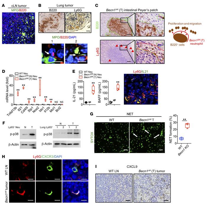 
Becn1 deficiency induces B cell helper protumorigenic function of neutr...