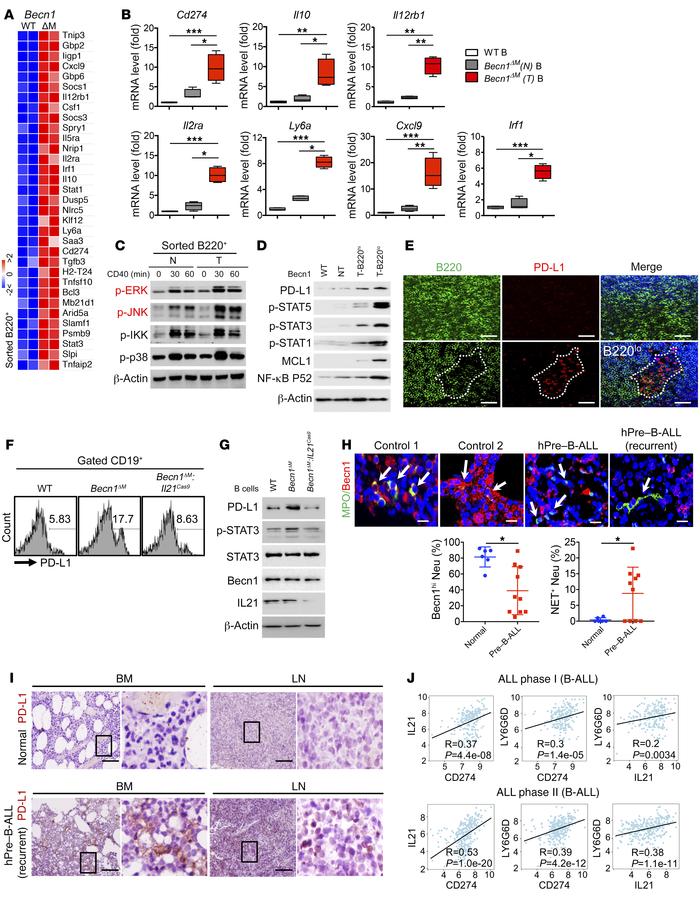 Neutrophil Becn1 levels correlate with PD-L1 in pre-B lymphoma.
(A and B...