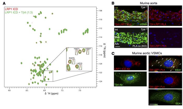 Tβ4 interacts with LRP1 in the endocytic compartment of aortic smooth mu...