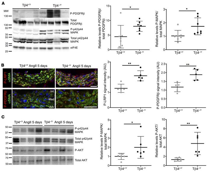 LRP1-mediated signaling is dysregulated in Tβ4-null aortas.
Baseline PDG...