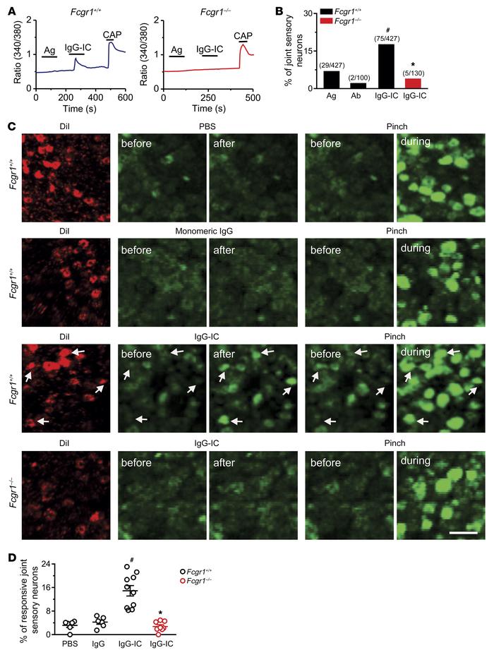 IgG-IC directly activates joint sensory neurons through FcγRI in vitro a...