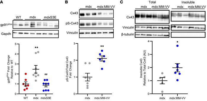 CaMKII oxidation leads to Cx43 hypophosphorylation in mdx hearts.
(A) Re...