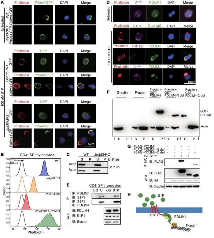 PDLIM4 regulates T cell migration by interaction with S1P1 and modulatio...