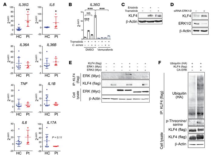 Blockade of the EGFR/MEK/ERK pathway increases keratinocyte expression o...