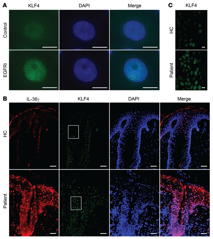 Increased KLF4 levels in vitro and in vivo upon EGFR inhibition.
(A) Rep...