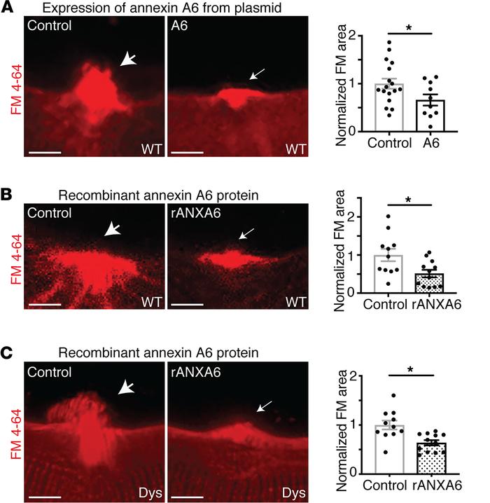 Annexin A6 enhanced membrane repair capacity of healthy and dystrophic m...