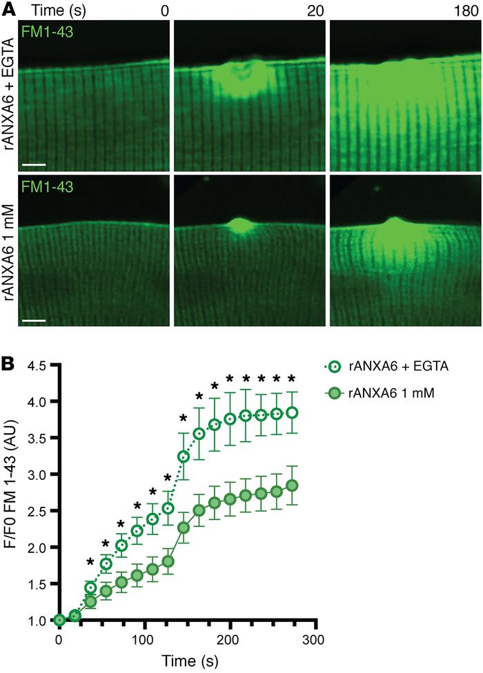 Ca2+ dependency of the protective effects of recombinant annexin A6.
(A ...