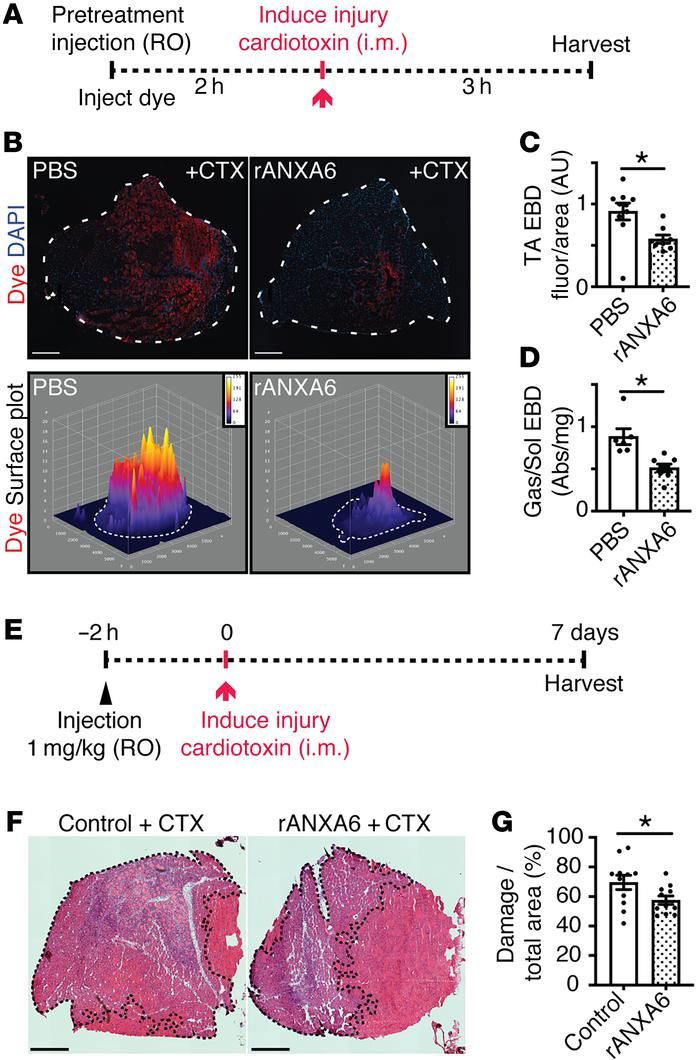 Systemic delivery using retro-orbital injection of recombinant annexin A...
