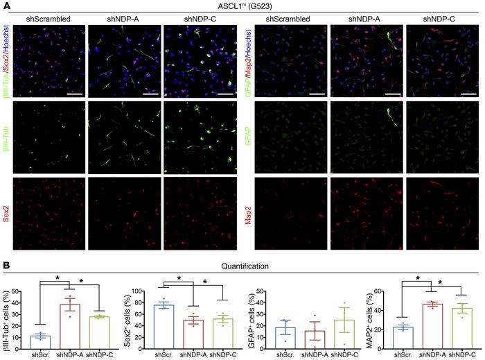 
NDP knockdown leads to differentiation in ASCL1hi GSCs.
(A) Representat...