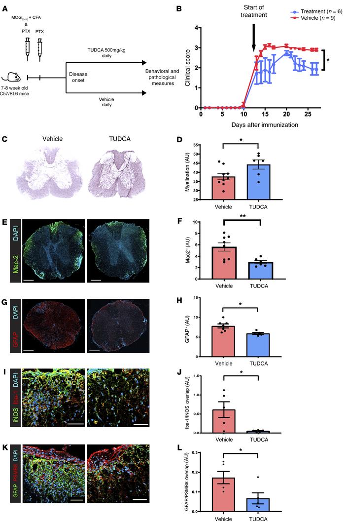 TUDCA supplementation ameliorates EAE.
(A) Eight- to 9-week-old female C...