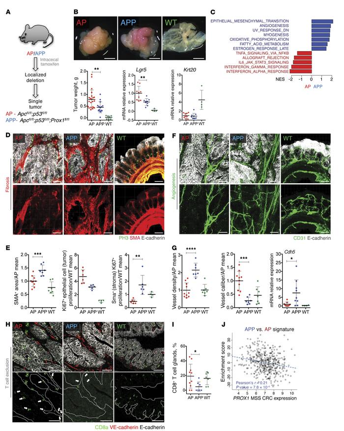 Inactivation of Prox1 generates desmoplastic, angiogenic, and T cell–exc...