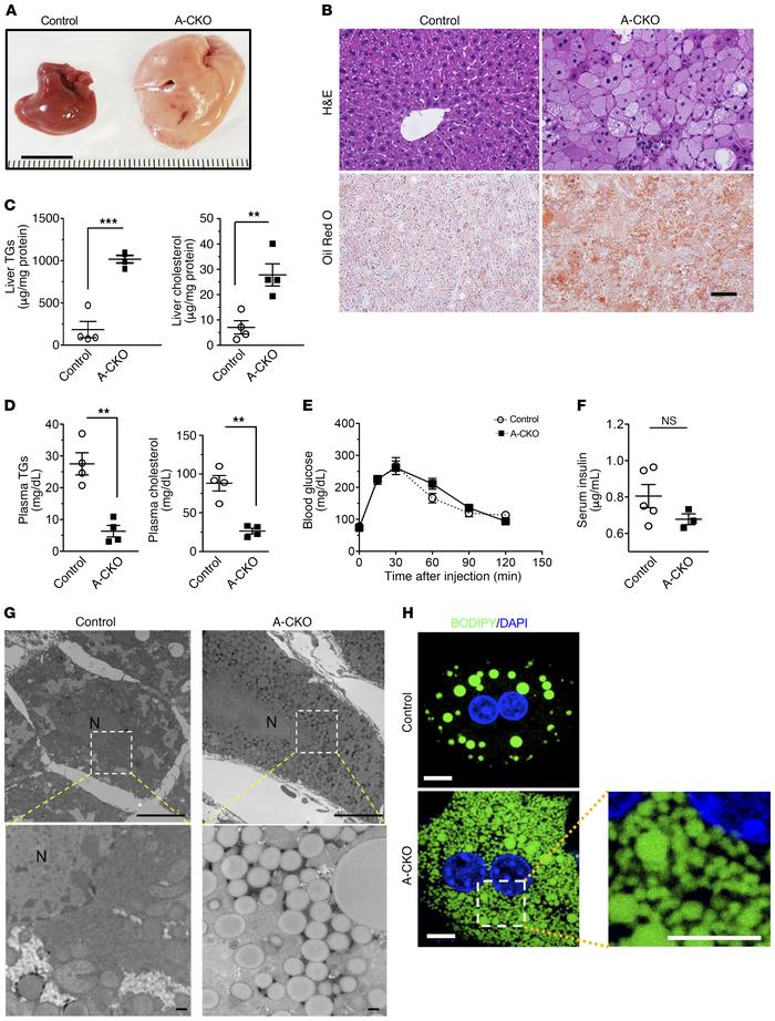 Hepatic steatosis without evidence of insulin resistance in male A-CKO m...