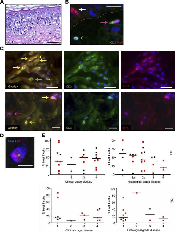 Host T cells in skin and gut during acute GVHD are activated.
(A) Exampl...