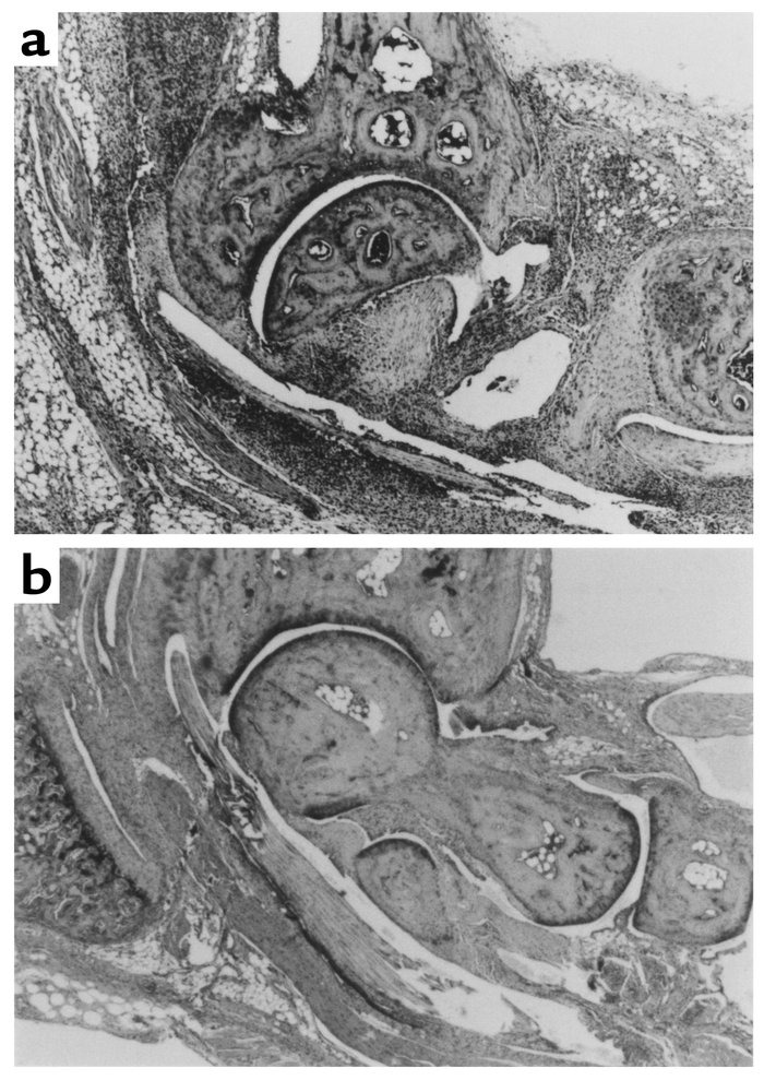 Histological examination of ankles from arthritic mice. Hematoxylin and ...