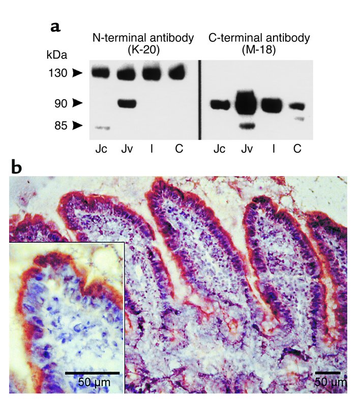 Expression of leptin receptor proteins in rat intestinal epithelium. (a)...