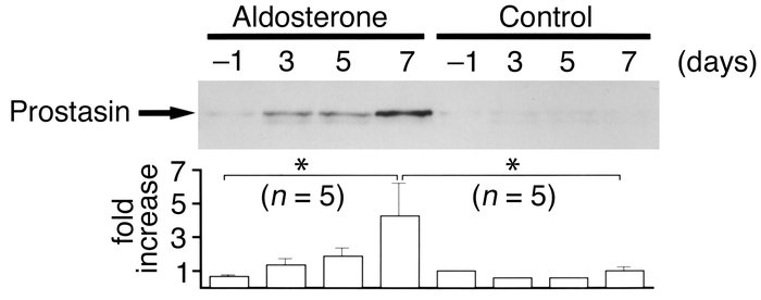 Effect of aldosterone infusion on prostasin excretion in the urine. Immu...