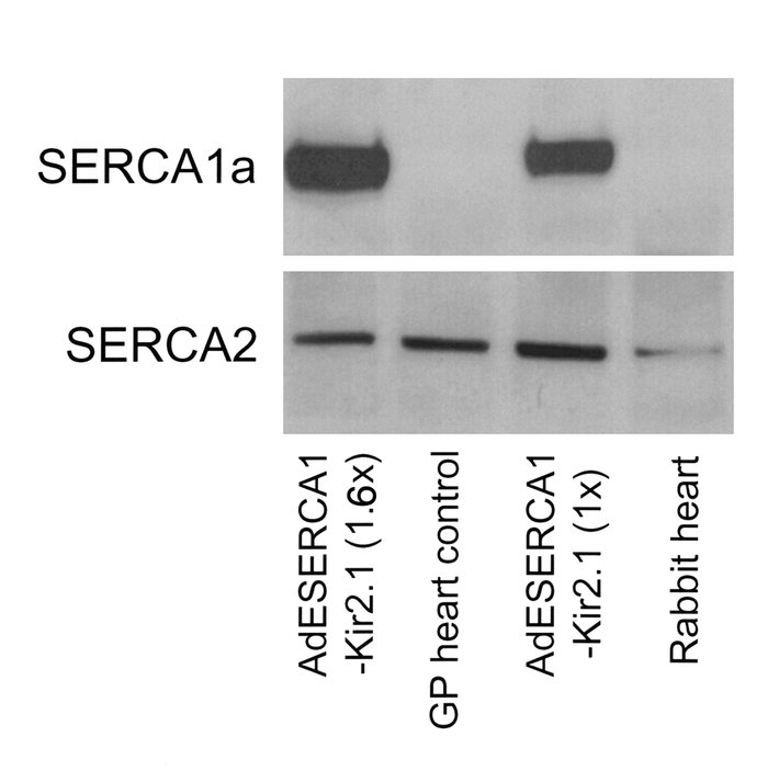 SERCA protein expression. When an mAb against SERCA1a (A52; ref. 14) was...