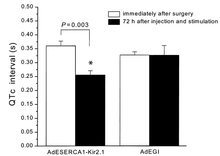 ECG analysis: QTc interval. A significant reduction was observed in the ...