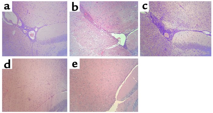 Histological evidence of EAE in wild-type, Ii p31, and Ii p41, but not I...