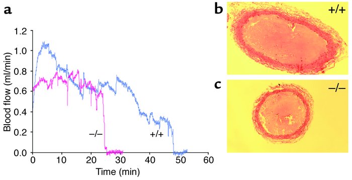 Thrombotic occlusion of the carotid artery. (a) Representative blood flo...