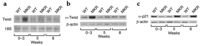 Differential expression of p21 and Twist in MKR mice. Hindlimb muscles w...