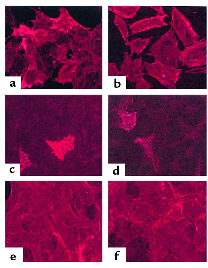 Immunocytochemical analysis of smooth muscle α-actin expression in perme...