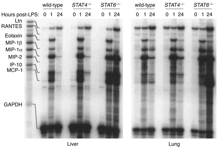Chemokine mRNA expression in liver and lung tissues during endotoxemia. ...