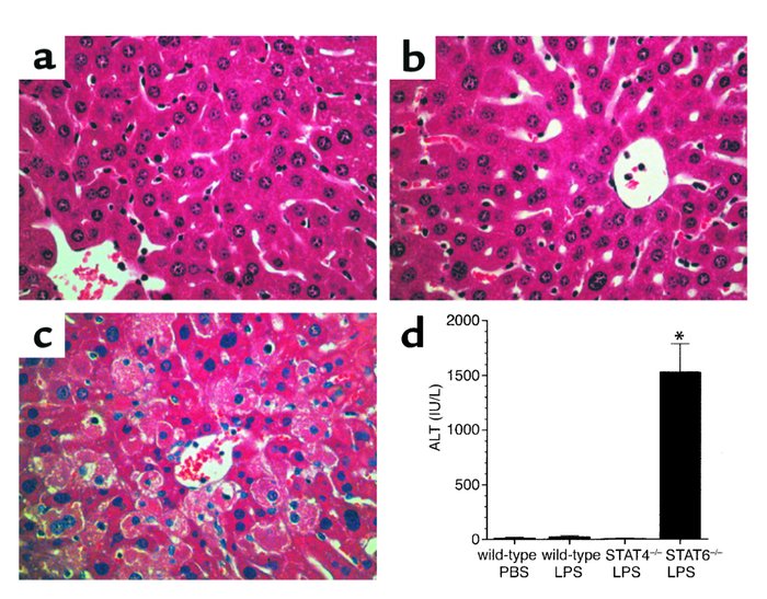 Endotoxemia causes hepatocellular injury in STAT6–/– mice. Liver section...